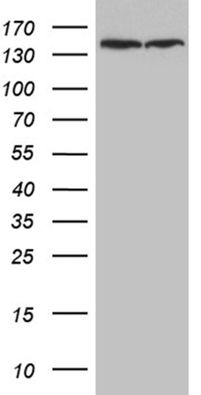 SMC1A Antibody in Western Blot (WB)