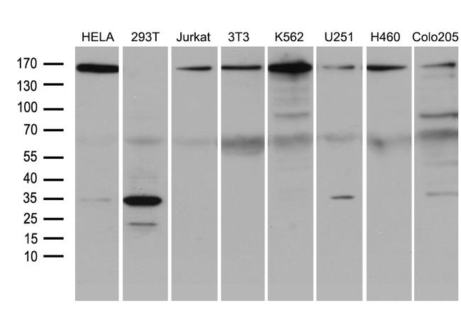 SMC1A Antibody in Western Blot (WB)