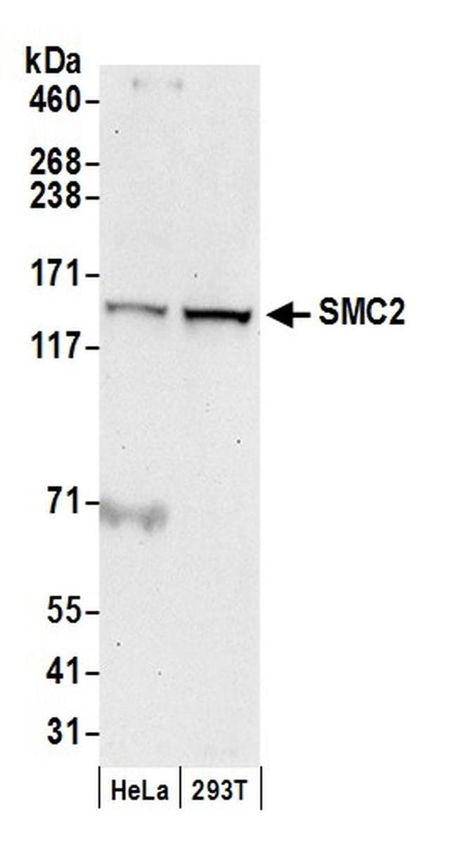 SMC2 Antibody in Western Blot (WB)