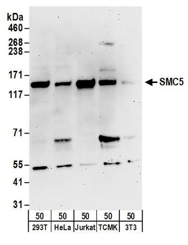 SMC5 Antibody in Western Blot (WB)