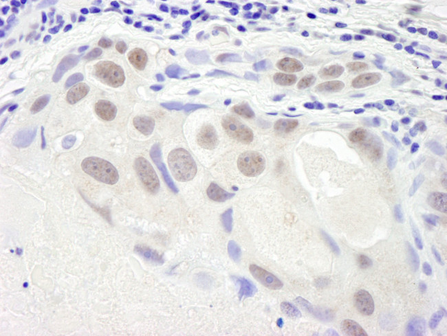 SMC6 Antibody in Immunohistochemistry (IHC)