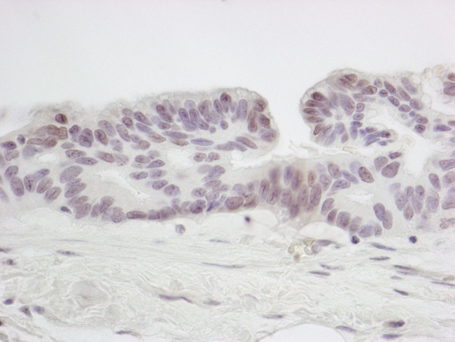 SMC6 Antibody in Immunohistochemistry (IHC)