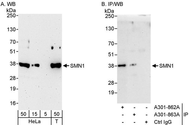 SMN1 Antibody in Western Blot (WB)