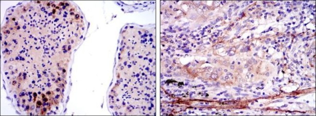 SMN1 Antibody in Immunohistochemistry (Paraffin) (IHC (P))