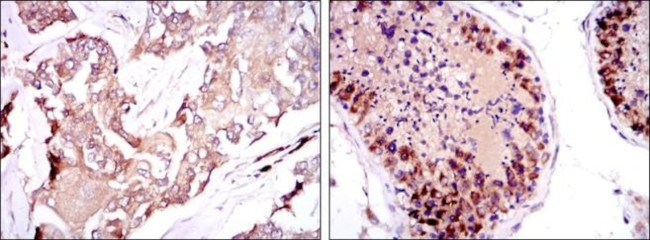 SMN1 Antibody in Immunohistochemistry (Paraffin) (IHC (P))