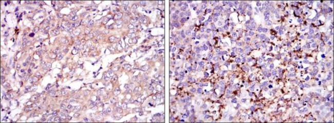 SMN1 Antibody in Immunohistochemistry (Paraffin) (IHC (P))