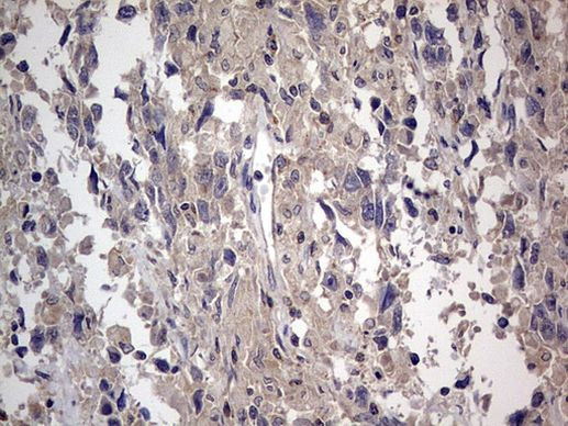 SMPD1 Antibody in Immunohistochemistry (Paraffin) (IHC (P))