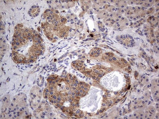 SMPD1 Antibody in Immunohistochemistry (Paraffin) (IHC (P))