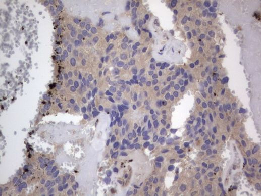 SMPD1 Antibody in Immunohistochemistry (Paraffin) (IHC (P))