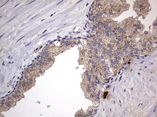 SMPD1 Antibody in Immunohistochemistry (Paraffin) (IHC (P))