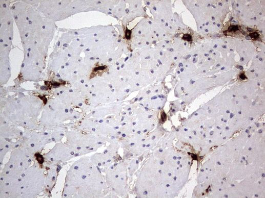 SMPD1 Antibody in Immunohistochemistry (Paraffin) (IHC (P))