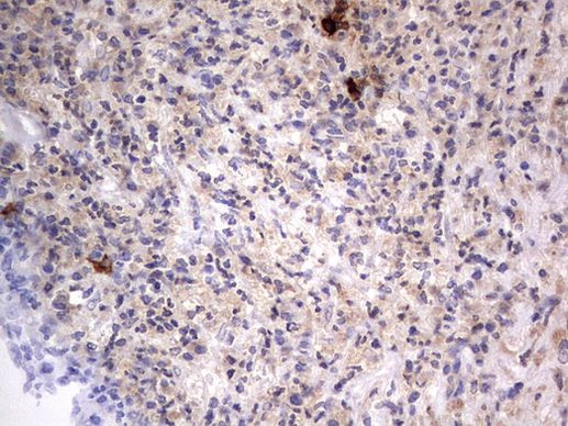 SMPD1 Antibody in Immunohistochemistry (Paraffin) (IHC (P))