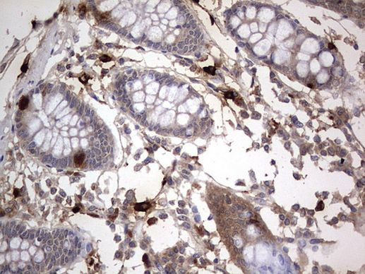 SMPD1 Antibody in Immunohistochemistry (Paraffin) (IHC (P))