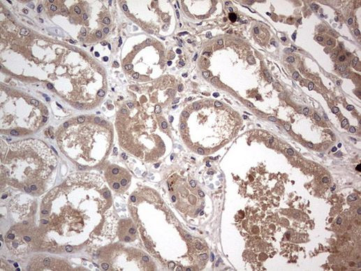 SMPD1 Antibody in Immunohistochemistry (Paraffin) (IHC (P))