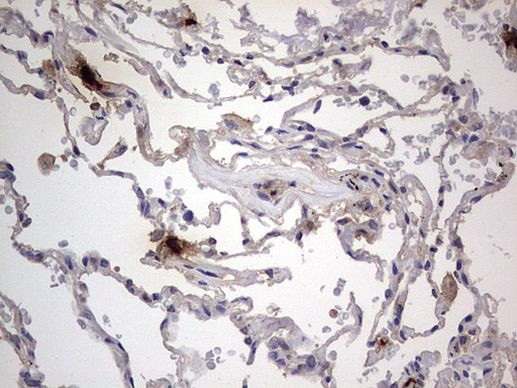 SMPD1 Antibody in Immunohistochemistry (Paraffin) (IHC (P))