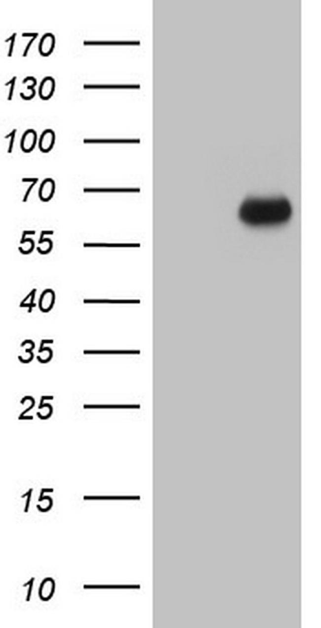 SMPD1 Antibody in Western Blot (WB)