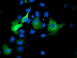 SMS Antibody in Immunocytochemistry (ICC/IF)