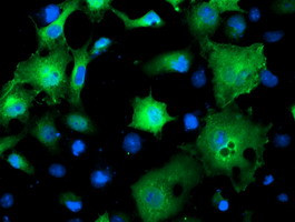 SMS Antibody in Immunocytochemistry (ICC/IF)