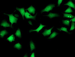 SMS Antibody in Immunocytochemistry (ICC/IF)