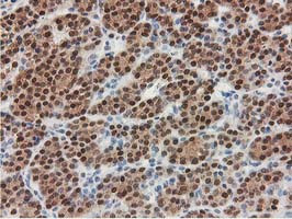 SMS Antibody in Immunohistochemistry (Paraffin) (IHC (P))