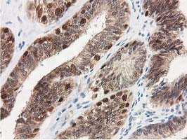 SMS Antibody in Immunohistochemistry (Paraffin) (IHC (P))