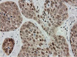 SMS Antibody in Immunohistochemistry (Paraffin) (IHC (P))