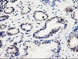 SMS Antibody in Immunohistochemistry (Paraffin) (IHC (P))