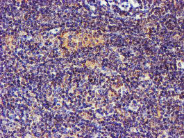 SMS Antibody in Immunohistochemistry (Paraffin) (IHC (P))