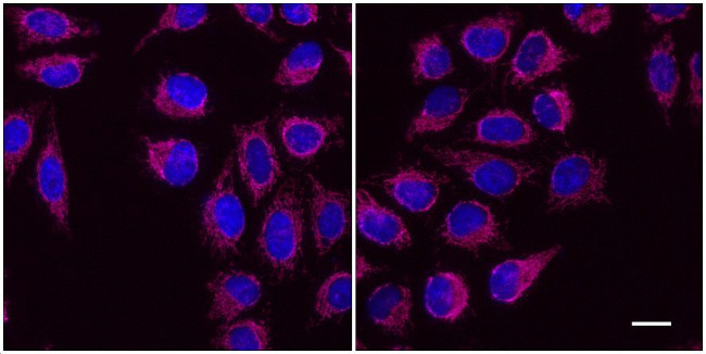 Mouse IgG1 VHH Secondary Antibody in Immunocytochemistry (ICC/IF)