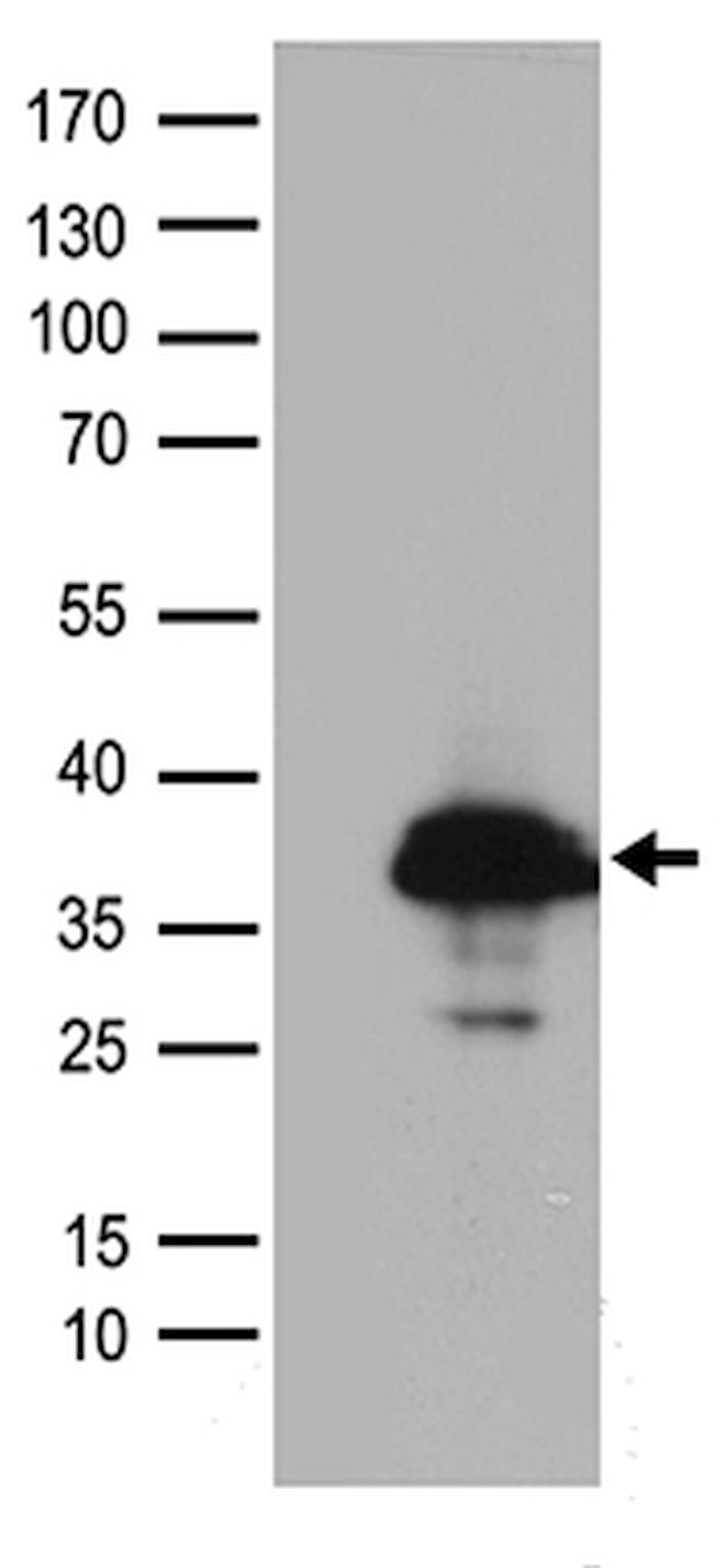 SMUG1 Antibody in Western Blot (WB)