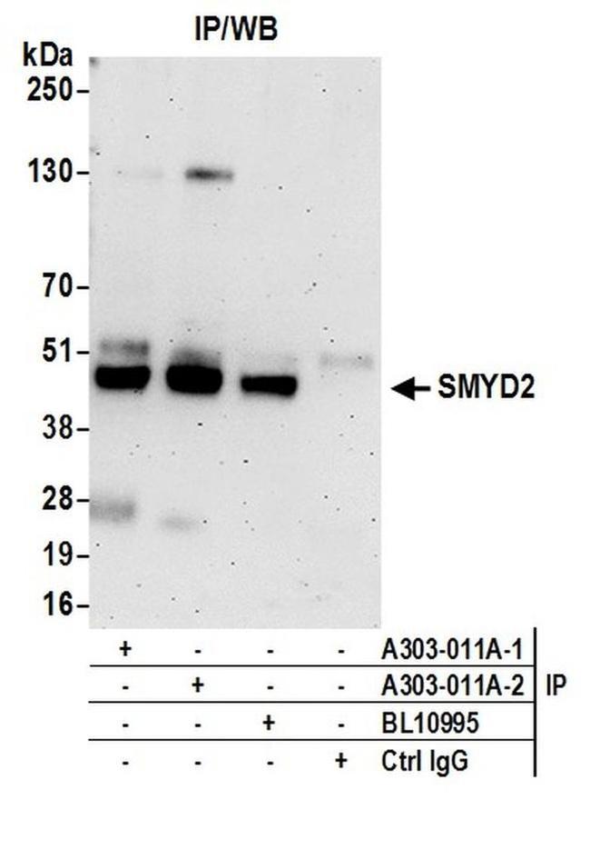 SMYD2 Antibody in Western Blot (WB)