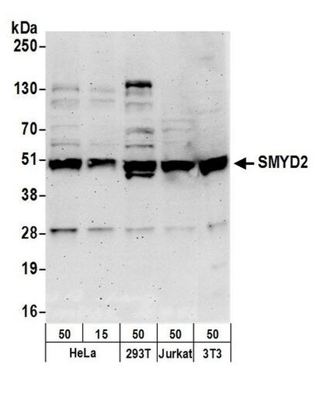 SMYD2 Antibody in Western Blot (WB)