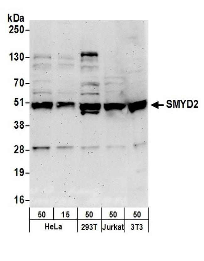 SMYD2 Antibody in Western Blot (WB)