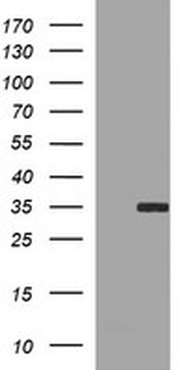 SNAI1 Antibody in Western Blot (WB)