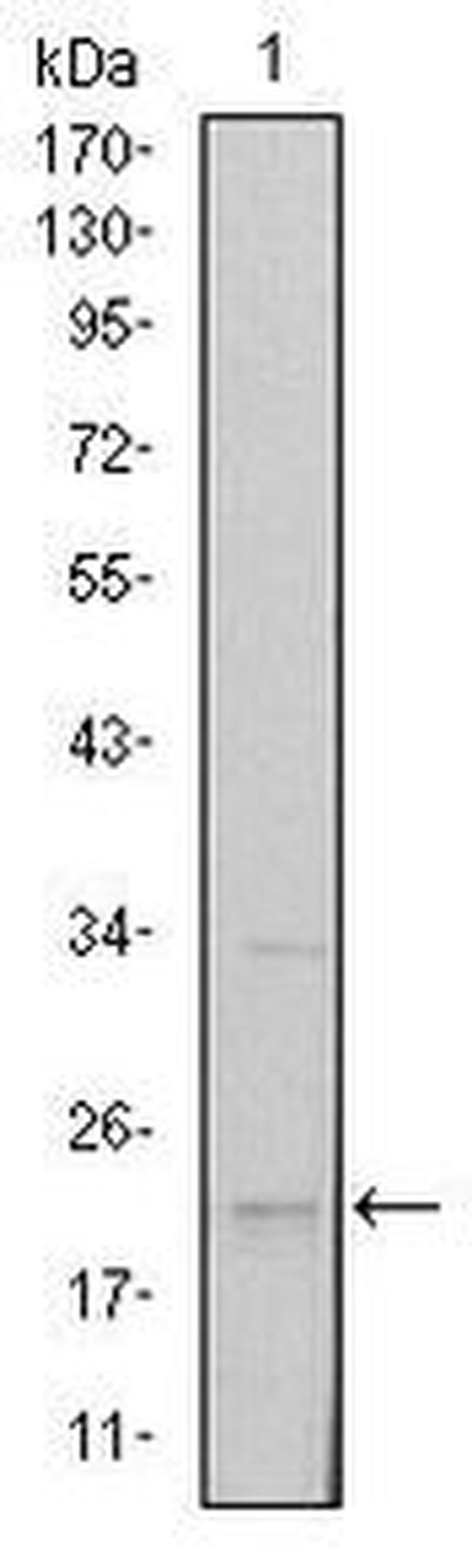 SNAIL Antibody in Western Blot (WB)