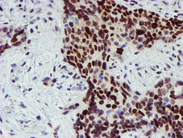 SNAI2 Antibody in Immunohistochemistry (Paraffin) (IHC (P))