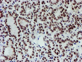 SNAI2 Antibody in Immunohistochemistry (Paraffin) (IHC (P))