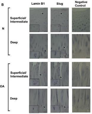 SNAI2 Antibody in Immunohistochemistry (Paraffin) (IHC (P))