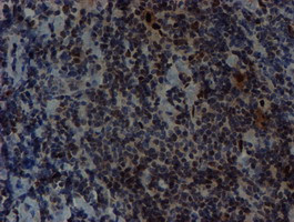 SNAI2 Antibody in Immunohistochemistry (Paraffin) (IHC (P))