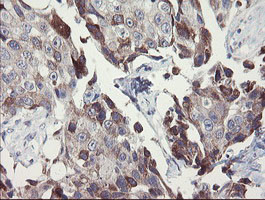 SNAI2 Antibody in Immunohistochemistry (Paraffin) (IHC (P))