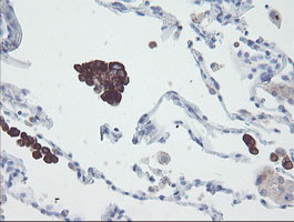 SNAI2 Antibody in Immunohistochemistry (Paraffin) (IHC (P))