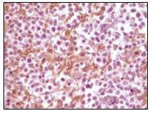 alpha Synuclein Antibody in Immunohistochemistry (Paraffin) (IHC (P))