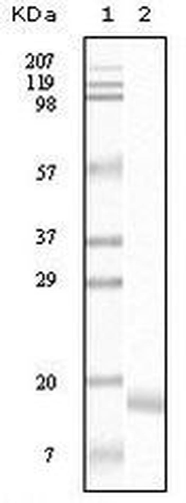 alpha Synuclein Antibody in Western Blot (WB)