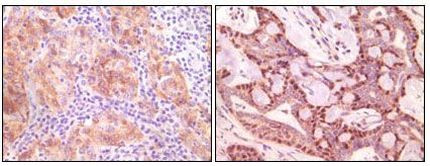 gamma Synuclein Antibody in Immunohistochemistry (Paraffin) (IHC (P))