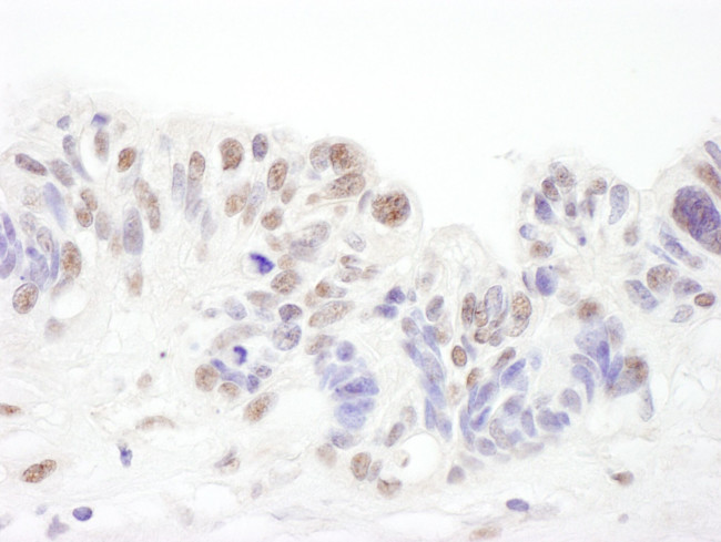 SNRPA1 Antibody in Immunohistochemistry (IHC)