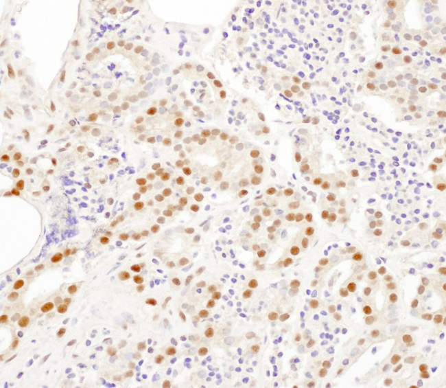 SNRPA1 Antibody in Immunohistochemistry (IHC)