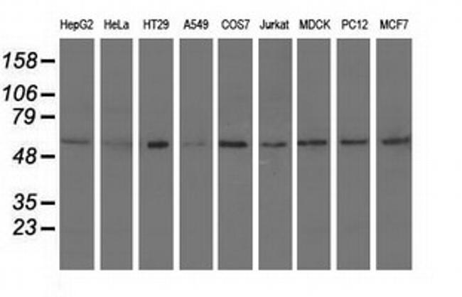 SNTA1 Antibody in Western Blot (WB)