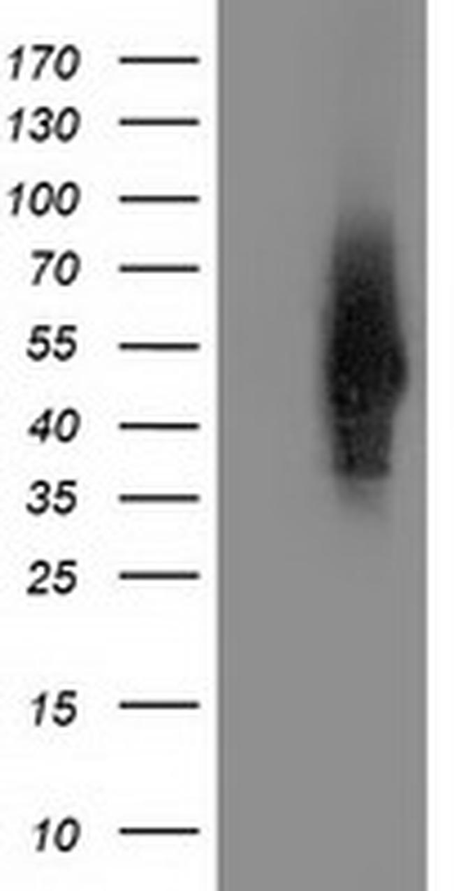 SNTA1 Antibody in Western Blot (WB)