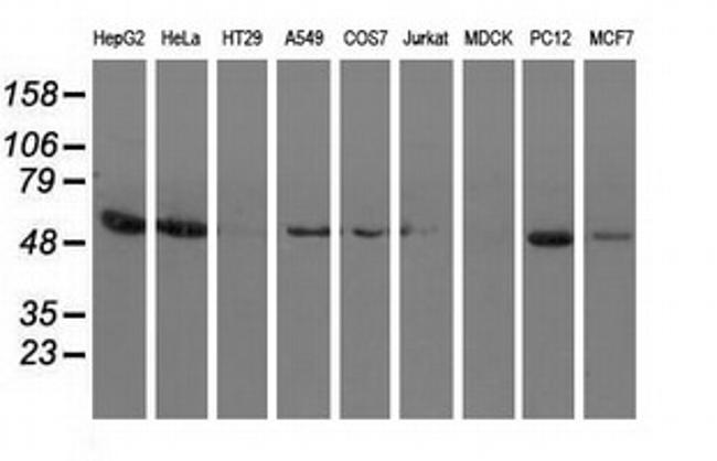 SNTA1 Antibody in Western Blot (WB)