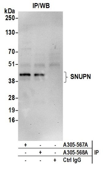 SNUPN Antibody in Immunoprecipitation (IP)